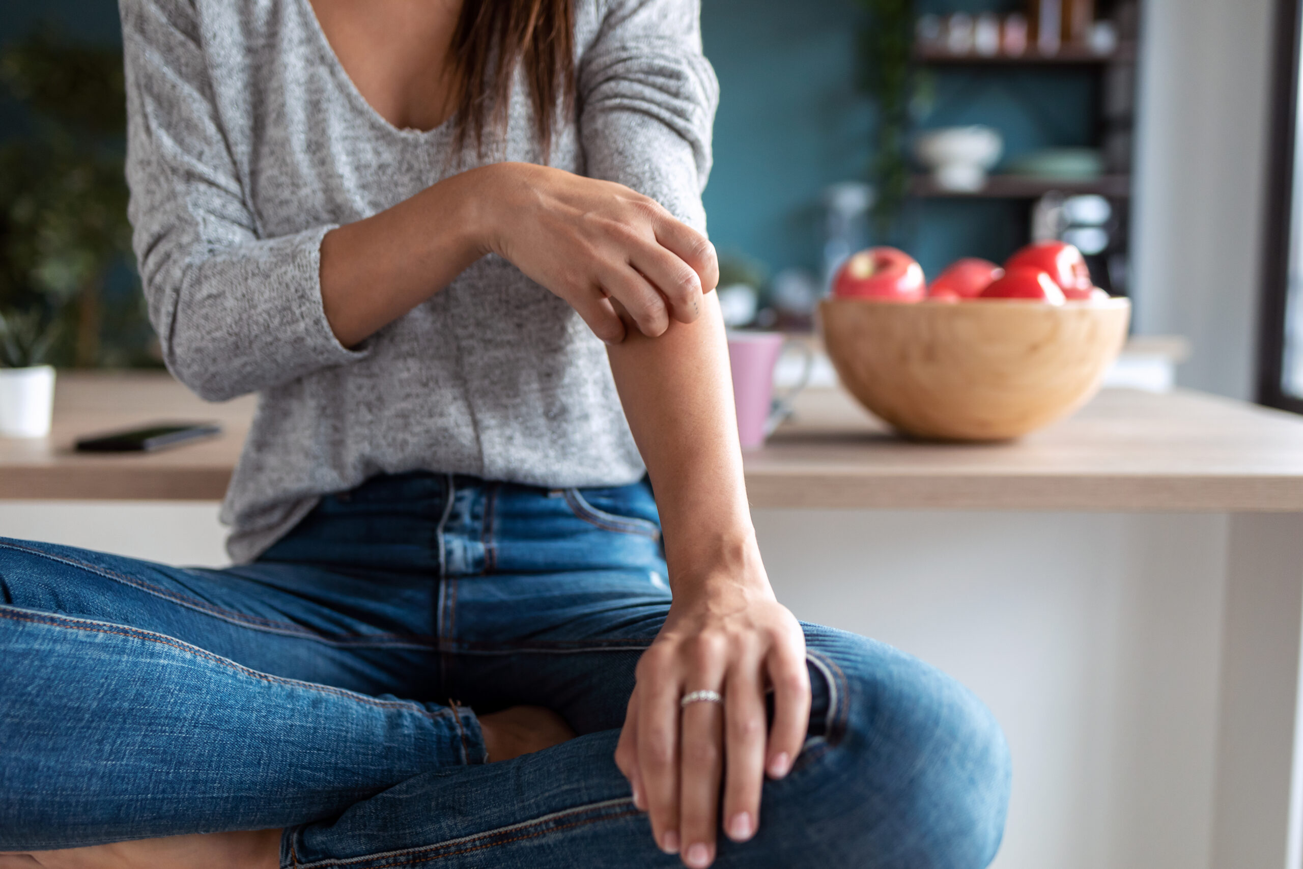 psoriasis va rating